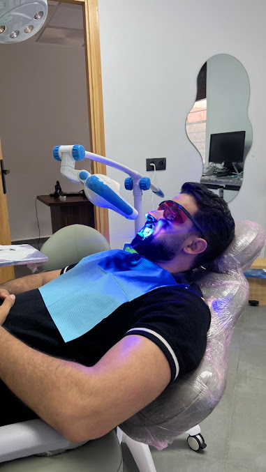 Résultat de blanchiment dentaire au Centre Dentaire Moumen à Casablanca